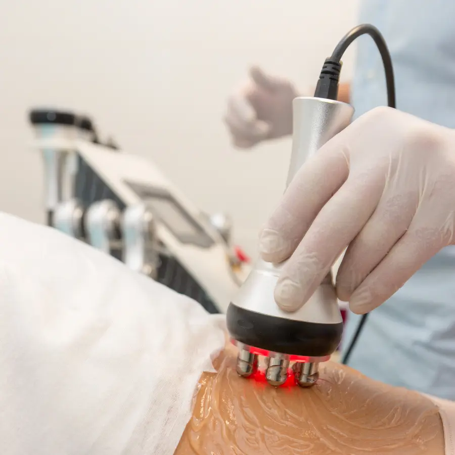 amincissement par radiofrequence