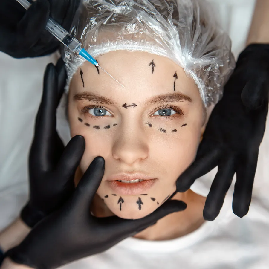 mesotherapie